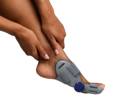 Tredia Bunion fix